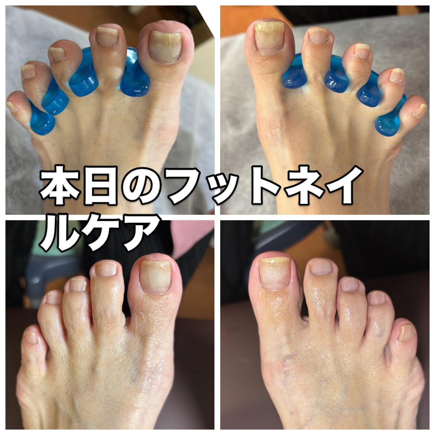 足を見ればわかる