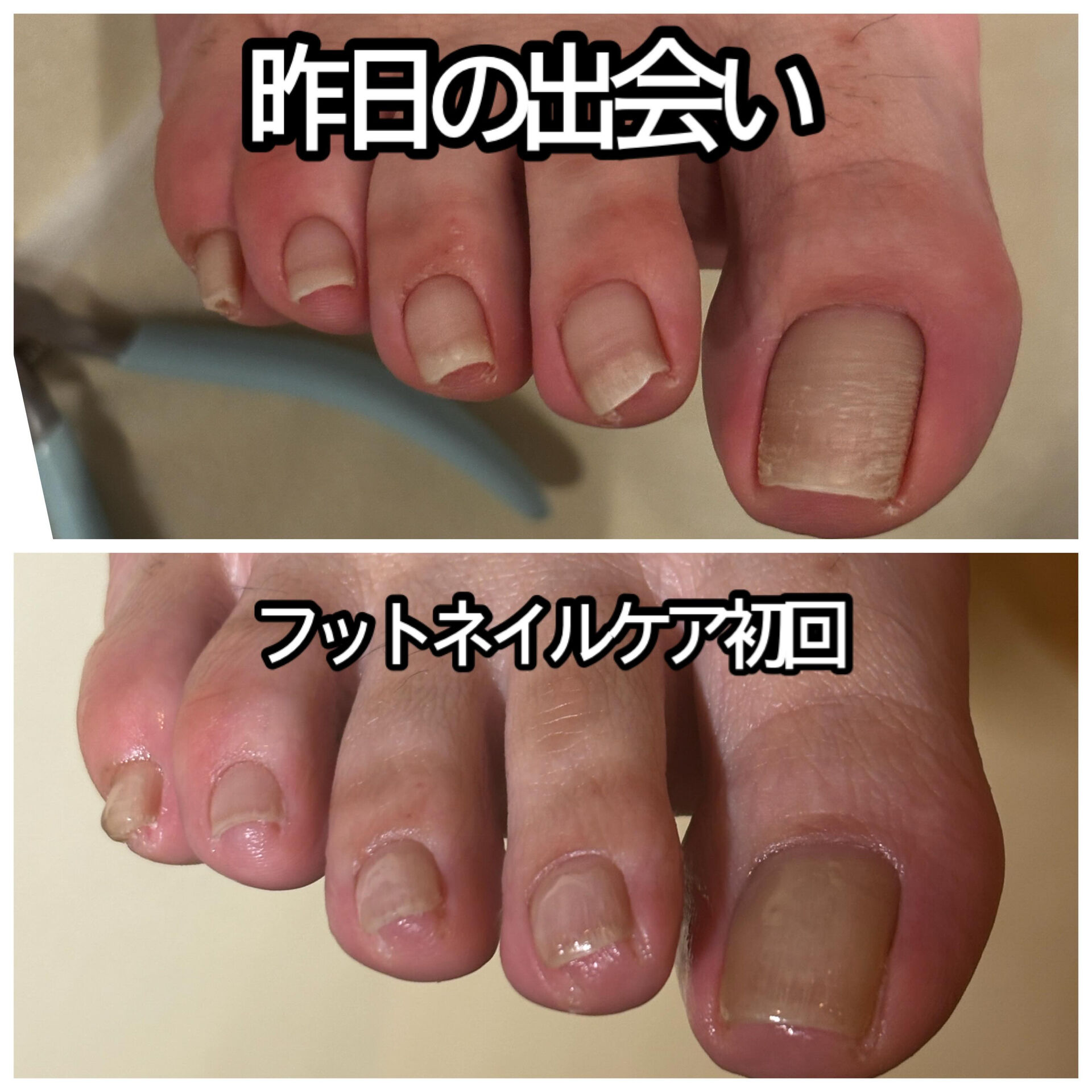 フットネイルケア初回の画像です