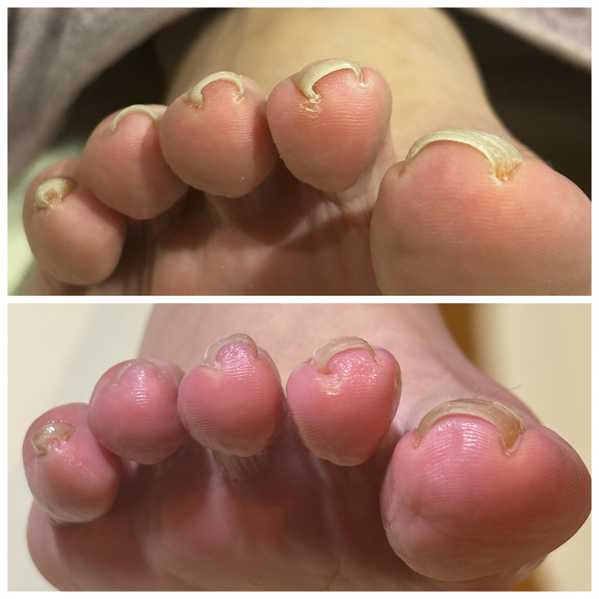フットネイルケア初回の画像です