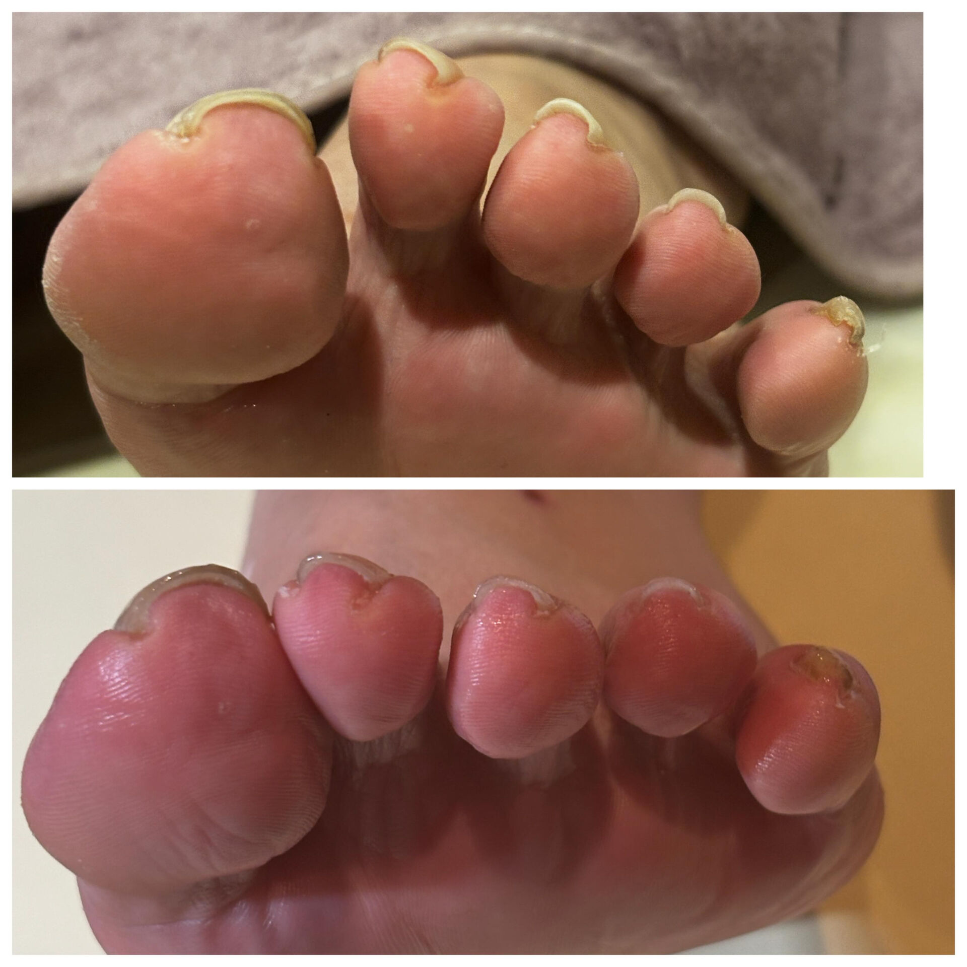 フットネイルケア初回の画像です